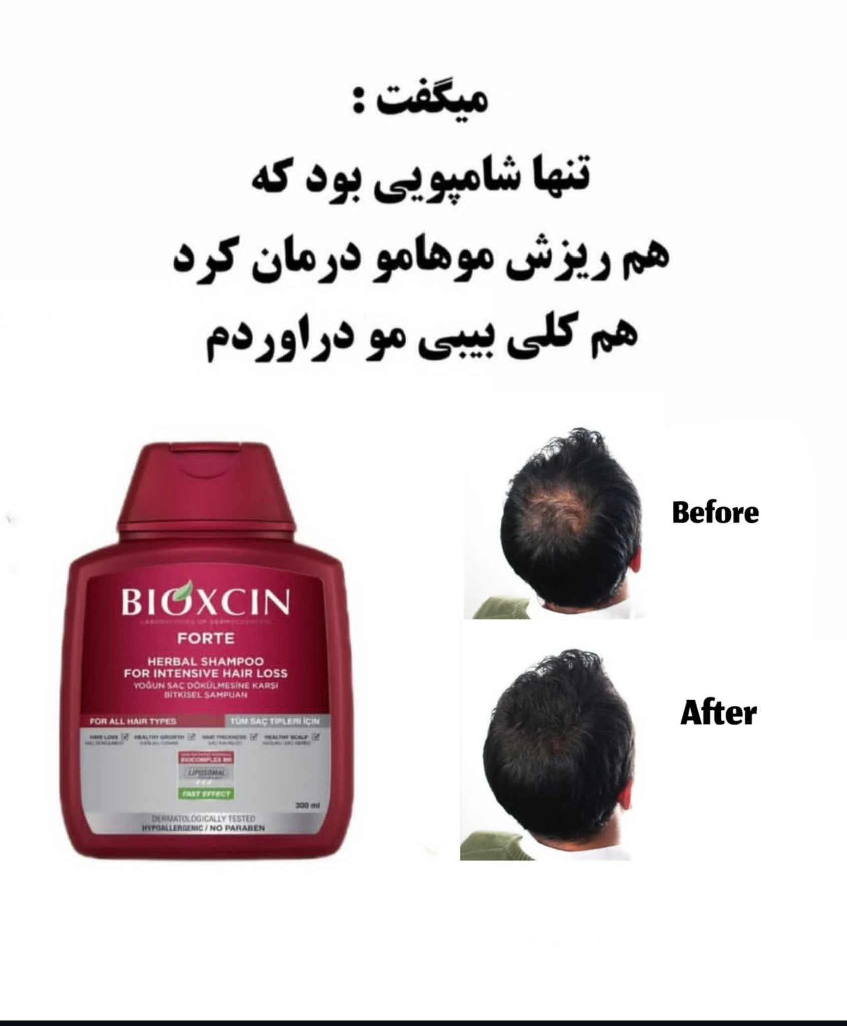 شامپو ضد ریزش بیوکسین قرمز